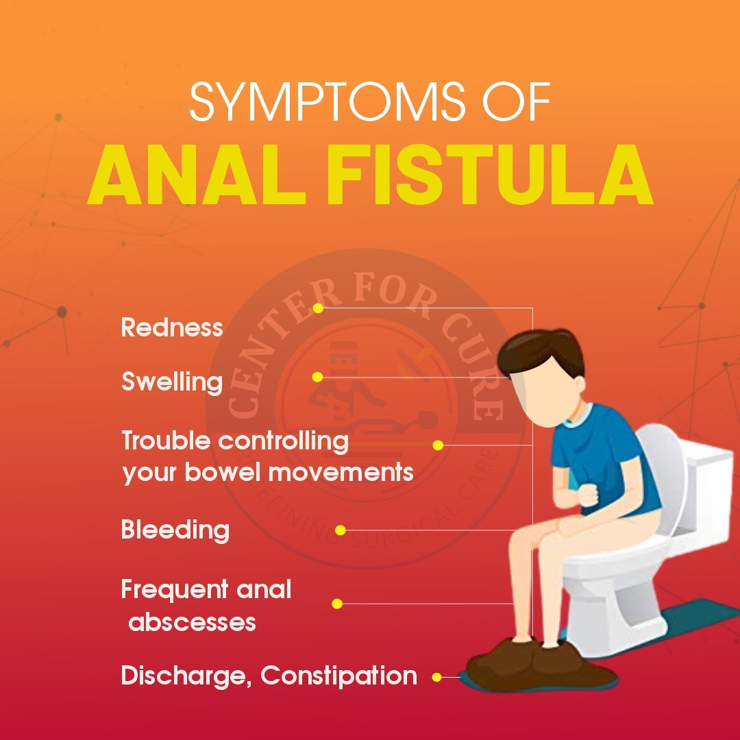 Fistula Natural Treatment